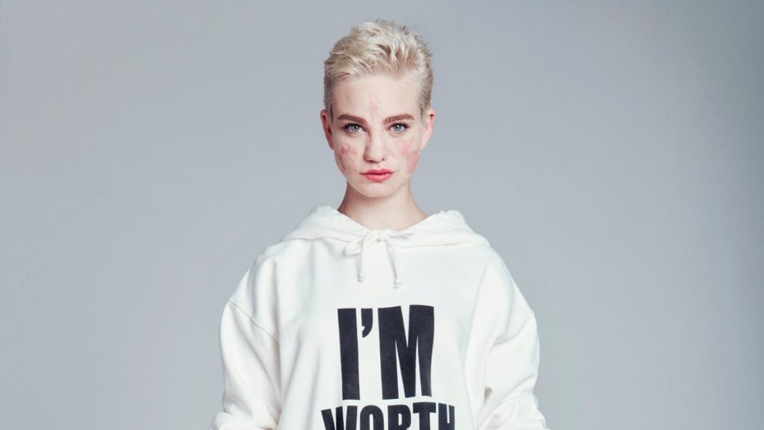 Chi è il fidanzato di Bebe Vio