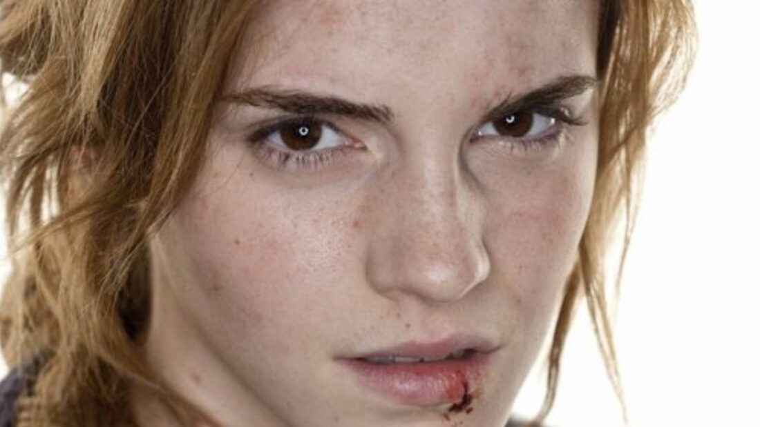 Perchè i mezzosangue sono in pericolo?