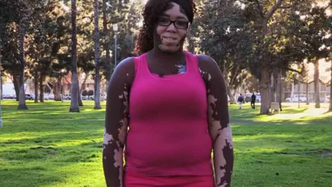 La donna con il corpo metà bianco e metà nero